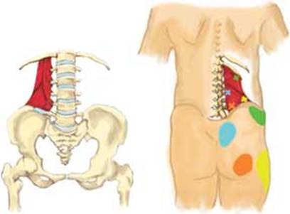 Боль в мышцах спины